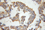 ENT1 Antibody in Immunohistochemistry (Paraffin) (IHC (P))