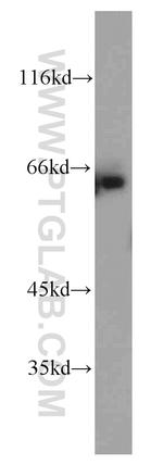 ENT1 Antibody in Western Blot (WB)