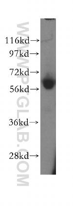 ENT1 Antibody in Western Blot (WB)