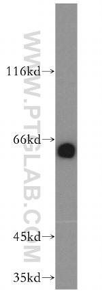 ENT1 Antibody in Western Blot (WB)