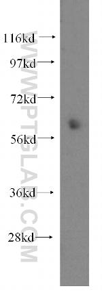 ENT1 Antibody in Western Blot (WB)