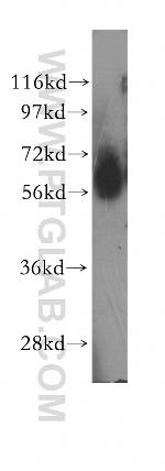 ENT1 Antibody in Western Blot (WB)