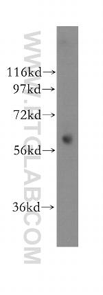ENT1 Antibody in Western Blot (WB)