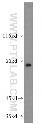 ENT1 Antibody in Western Blot (WB)
