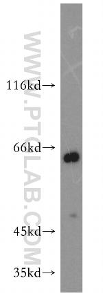 ENT1 Antibody in Western Blot (WB)