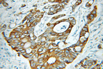KRT81 Antibody in Immunohistochemistry (Paraffin) (IHC (P))