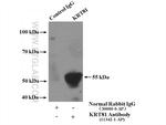 KRT81 Antibody in Immunoprecipitation (IP)