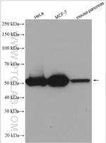 KRT81 Antibody in Western Blot (WB)