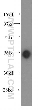 KRT81 Antibody in Western Blot (WB)