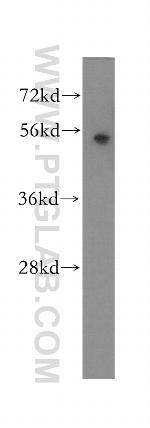 KRT81 Antibody in Western Blot (WB)