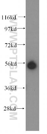 KRT81 Antibody in Western Blot (WB)