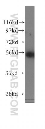 KRT81 Antibody in Western Blot (WB)