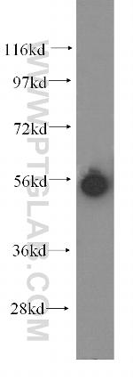 KRT81 Antibody in Western Blot (WB)