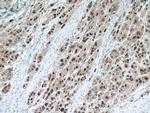 HDGF Antibody in Immunohistochemistry (Paraffin) (IHC (P))