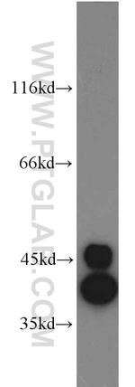 HDGF Antibody in Western Blot (WB)