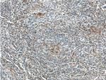 FLI1 Antibody in Immunohistochemistry (Paraffin) (IHC (P))