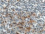 FLI1 Antibody in Immunohistochemistry (Paraffin) (IHC (P))
