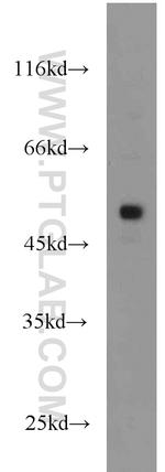 FLI1 Antibody in Western Blot (WB)
