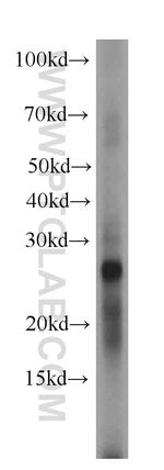 MYDGF Antibody in Western Blot (WB)
