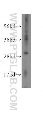 MYDGF Antibody in Western Blot (WB)