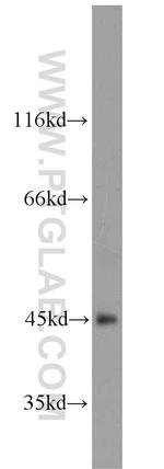 ART5 Antibody in Western Blot (WB)