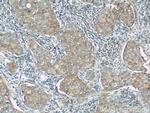 LGP2 Antibody in Immunohistochemistry (Paraffin) (IHC (P))