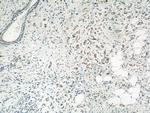 LGP2 Antibody in Immunohistochemistry (Paraffin) (IHC (P))