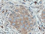 LGP2 Antibody in Immunohistochemistry (Paraffin) (IHC (P))