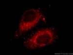 fibrosin Antibody in Immunocytochemistry (ICC/IF)