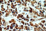 fibrosin Antibody in Immunohistochemistry (Paraffin) (IHC (P))