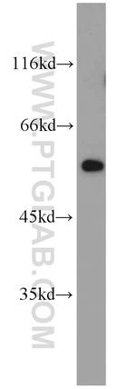 fibrosin Antibody in Western Blot (WB)