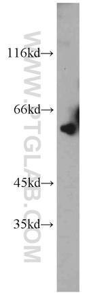 fibrosin Antibody in Western Blot (WB)