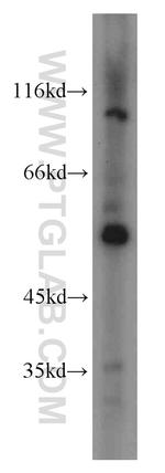 fibrosin Antibody in Western Blot (WB)