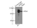 DDX1 Antibody in Immunoprecipitation (IP)