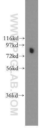 DDX1 Antibody in Western Blot (WB)