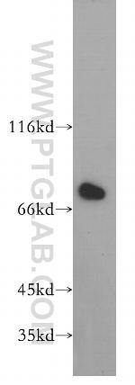 Harmonin Antibody in Western Blot (WB)