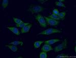 UMP/CMP kinase Antibody in Immunocytochemistry (ICC/IF)