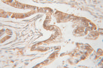 UMP/CMP kinase Antibody in Immunohistochemistry (Paraffin) (IHC (P))