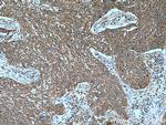UMP/CMP kinase Antibody in Immunohistochemistry (Paraffin) (IHC (P))