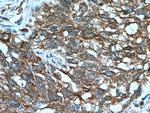 UMP/CMP kinase Antibody in Immunohistochemistry (Paraffin) (IHC (P))