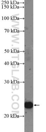 UMP/CMP kinase Antibody in Western Blot (WB)