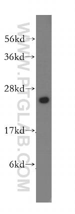 UMP/CMP kinase Antibody in Western Blot (WB)