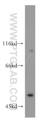 Dynamitin (1-401 AA) Antibody in Western Blot (WB)