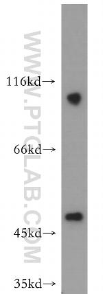 Dynamitin (1-401 AA) Antibody in Western Blot (WB)