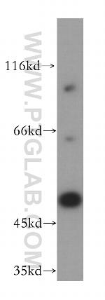 Dynamitin (1-401 AA) Antibody in Western Blot (WB)