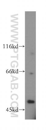 Dynamitin (1-401 AA) Antibody in Western Blot (WB)