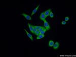 ARHGEF1 Antibody in Immunocytochemistry (ICC/IF)