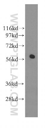 RAD23A Antibody in Western Blot (WB)
