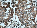 NCKIPSD Antibody in Immunohistochemistry (Paraffin) (IHC (P))