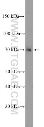 NCKIPSD Antibody in Western Blot (WB)
